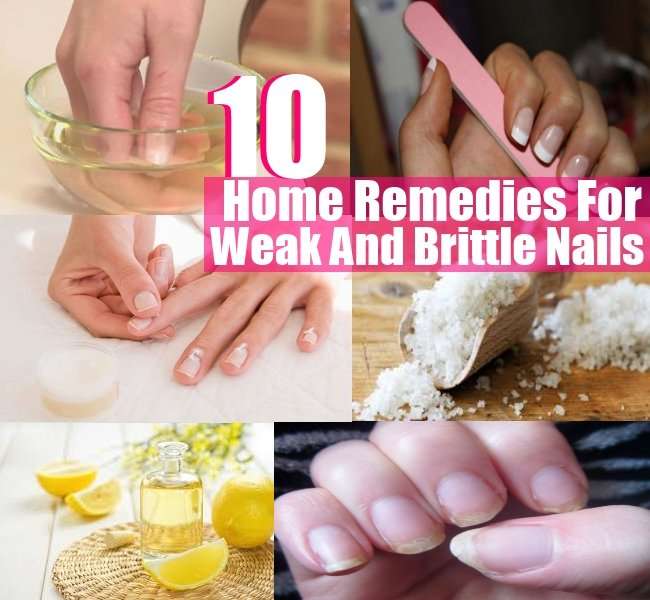 Top 10 Home Remedies For Weak And Brittle Nails